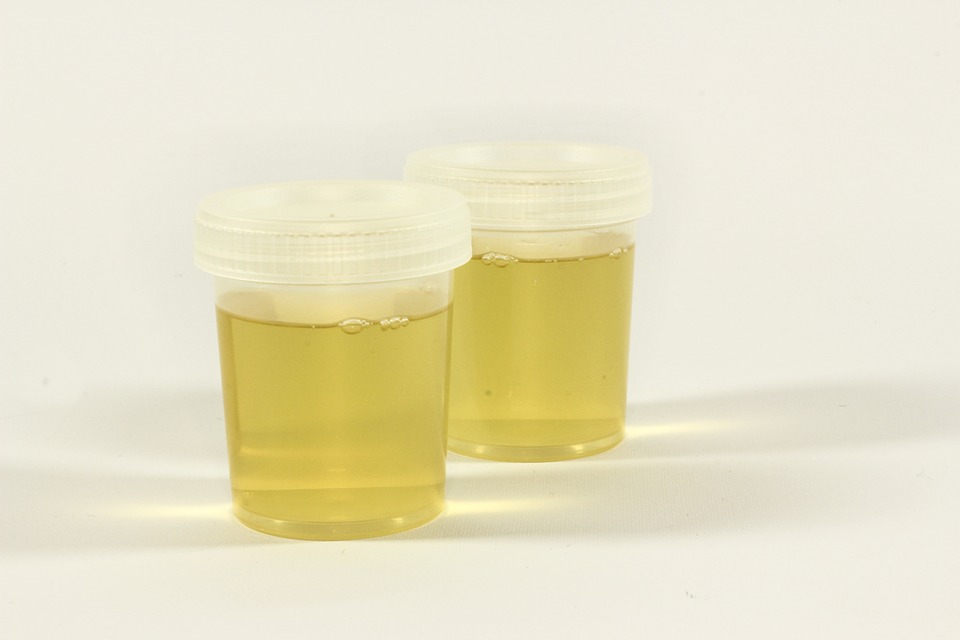 urine sample